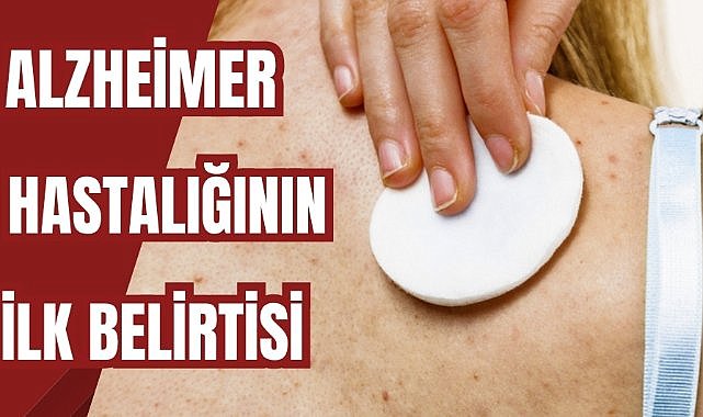 Alzheimer hastalığının ilk belirtisi