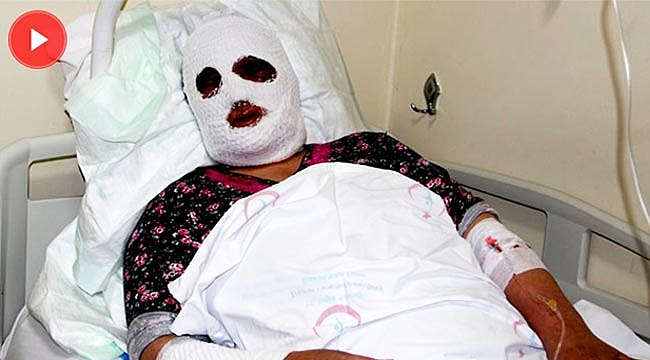 Temizlik yaparken bu hale geldi