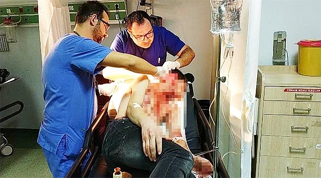 Travestinin usturalı saldırısına uğrayan genç ölümden döndü