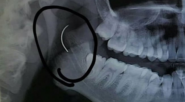 Doktor görünce şok oldu