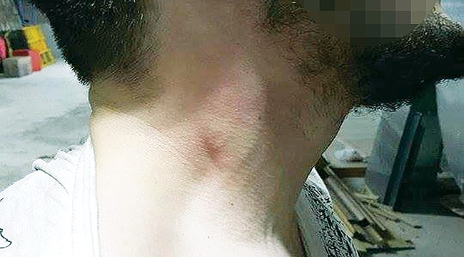 Yine dayak yine skandal