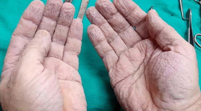 Cerrahın elleri sosyal medyayı salladı
