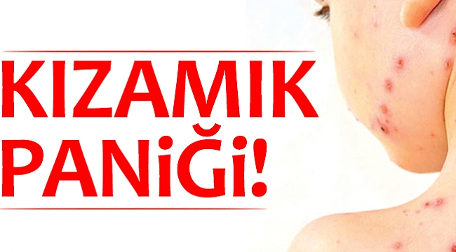 KIZAMIK PANİĞİ!