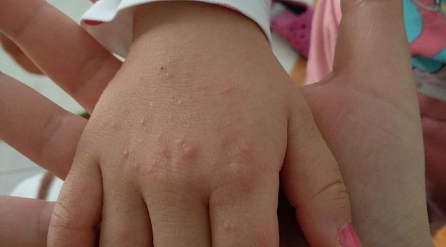 Atakum'da salgın iddiası