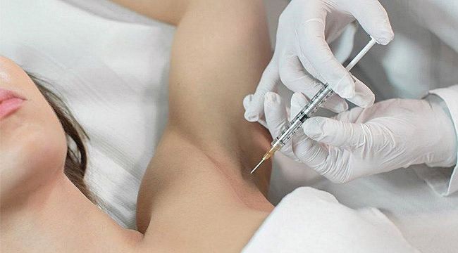 Aşırı terlemeye botoks tedavisi önerisi