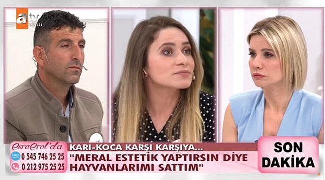 Estetik yaptırıp evden kaçtı