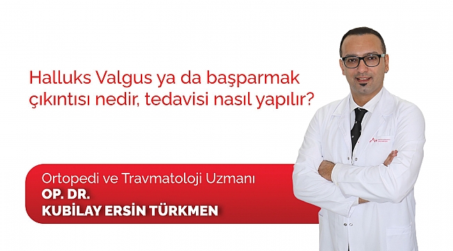 Başparmak çıkıntısı ve tedavisi