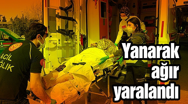 Yanarak ağır yaralandı