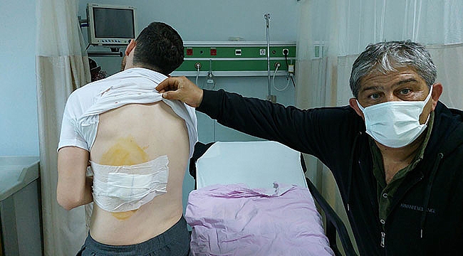 Sokak köpeğinin saldırısına uğradı