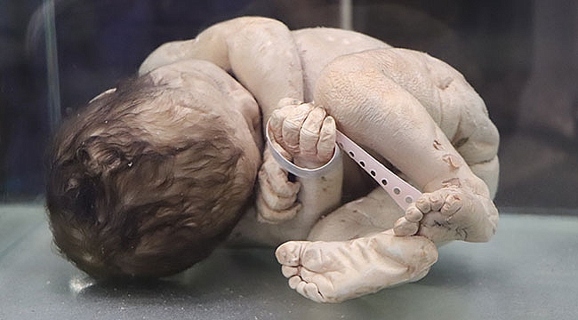 Asırlık cerrahi aletler bu müzede