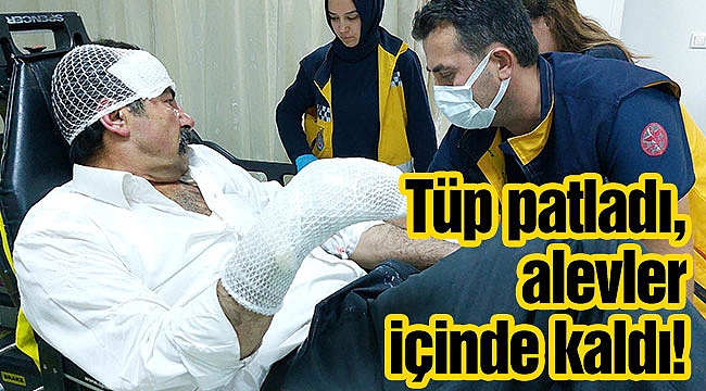 Tüp patladı, alevler içinde kaldı!