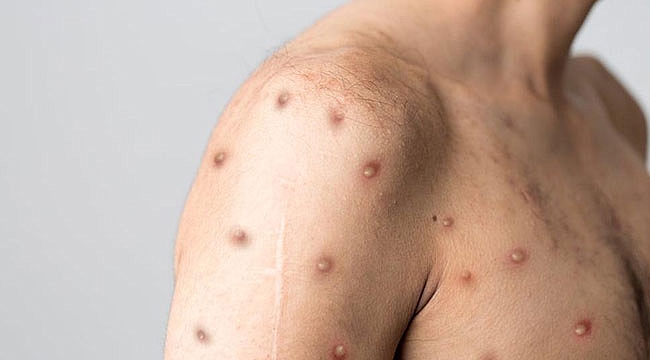 Bilim insanları uyardı