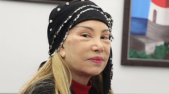 Bedia Akartürk 81 yaşında estetik oldu