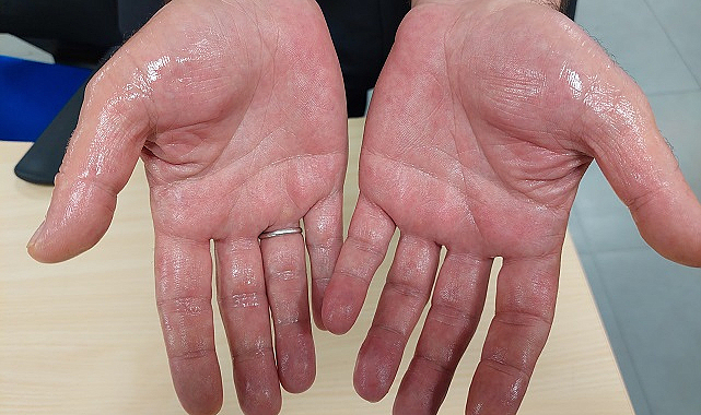 Terlemeye terletmeyen çözüm