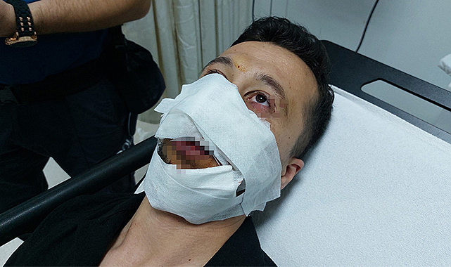 Kına gecesini kana bulamıştı, adli kontrolle serbest