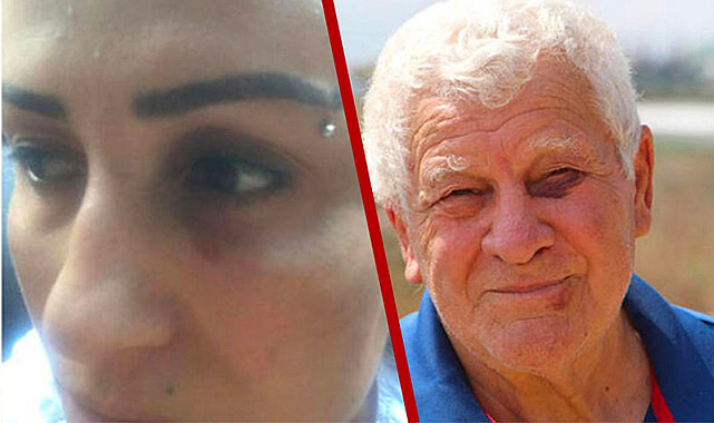 Sokak köpeklerini besledikleri için darpedildiler