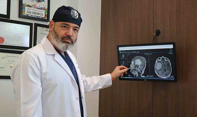 'Beyin tümörlerinde zaman kaybı ölüme yol açıyor'