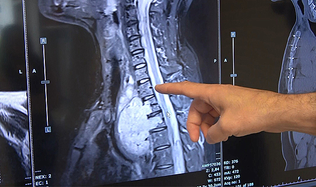 Yaşama şansın düşük denildi, Samsun'da hayata tutundu