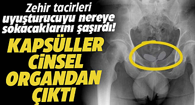 O şehirde iki kadının iç genital bölge ile anüsünden uyuşturucu çıktı!