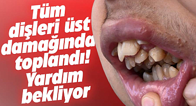 Samsun'da dram! Mamalarla beslenen Yaşar Hüseyin yardım bekliyor