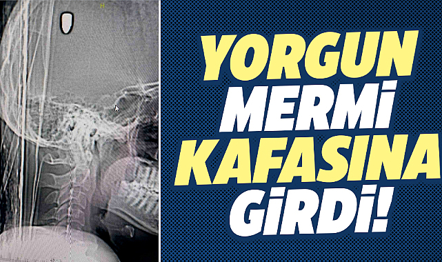 Samsun'da sokakta arkadaşını bekleyen gencin kafasına yorgun mermi girdi