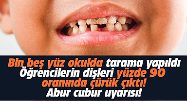 Samsun'da dişleri çürük çıkan öğrencilere  doktorlar 'abur cubur' uyarısı yaptı