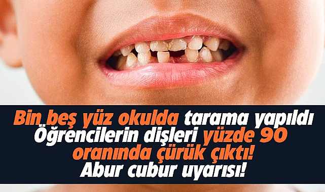 Samsun'da dişleri çürük çıkan öğrencilere  doktorlar 'abur cubur' uyarısı yaptı
