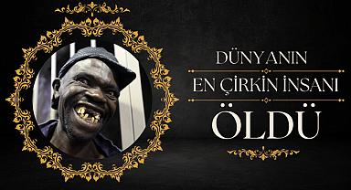 Dünyanın en çirkin insanı Maison Sere öldü