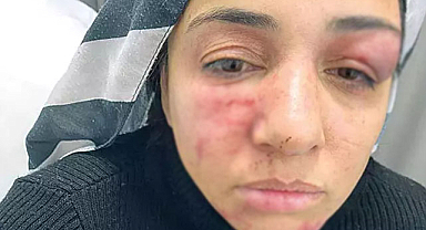 Songül Kaya, sokak ortasında sopalı saldırıya uğradı