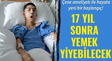 Çene ameliyatı ile hayat yeni bir başlangıç! 17 yıl sonra yemek yiyebilecek