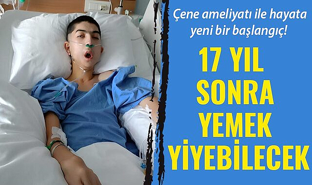 Çene ameliyatı ile hayat yeni bir başlangıç! 17 yıl sonra yemek yiyebilecek