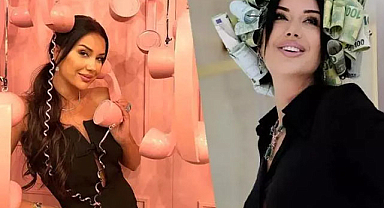 Dilan Polat'ın estetiksiz hali 