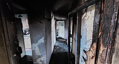 Samsun'da yangında 1 kişi hastanelik oldu