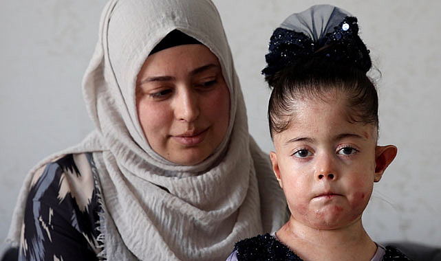 Tek dileği kelebek hastası kızına doyasıya sarılabilmek