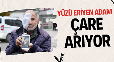 Yüzü eriyen adam tedavi olmak istiyor 
