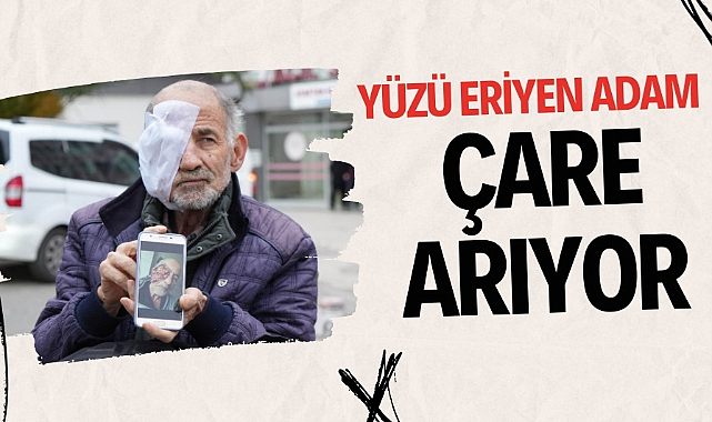 Yüzü eriyen adam tedavi olmak istiyor 