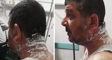 Ev sahibi tartıştığı kiracısına asitle saldırdı