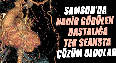Samsun'da nadir görülen hastalığa tek seansta çözüm oldular