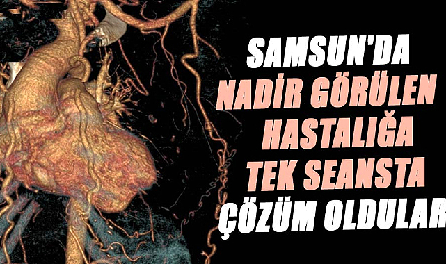 Samsun'da nadir görülen hastalığa tek seansta çözüm oldular