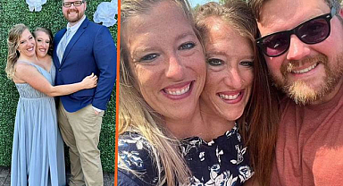 Yapışık ikizler evlendi: Çocuk sahibi olmak istiyorlar