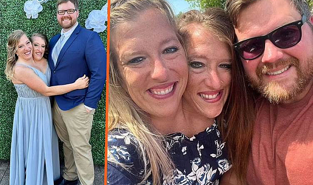 Yapışık ikizler evlendi: Çocuk sahibi olmak istiyorlar