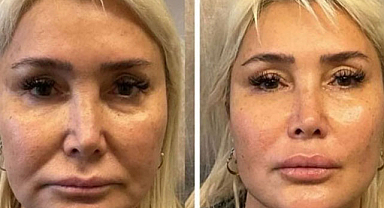 Yonca Evcimik bambaşka biri oldu