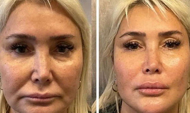 Yonca Evcimik bambaşka biri oldu