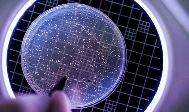 Bilim insanları kana susamış "vampir bakteriler" keşfetti