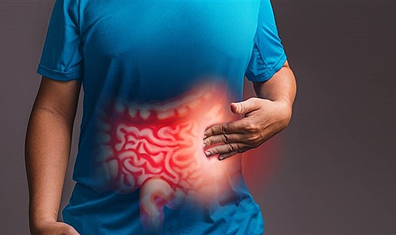 Kalın Bağırsak iltihabı nedir? Belirtileri ve tedavisi nasıldır?
