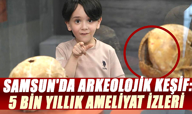Samsun'da arkeolojik keşif: 5 bin yıllık ameliyat izleri