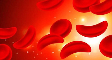 Yeni araştırma: A kan grubunun felç riski yüksek