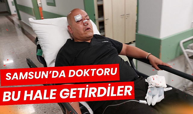 Samsun'da doktora darp! Hasta yakını burnunu kırdı