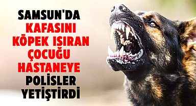 Samsun'da kafasını köpek ısıran çocuğu hastaneye polisler yetiştirdi