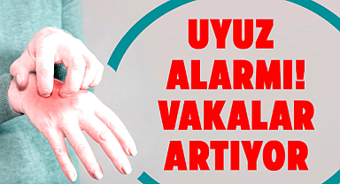 Uyuz alarmı! Vakalar artıyor